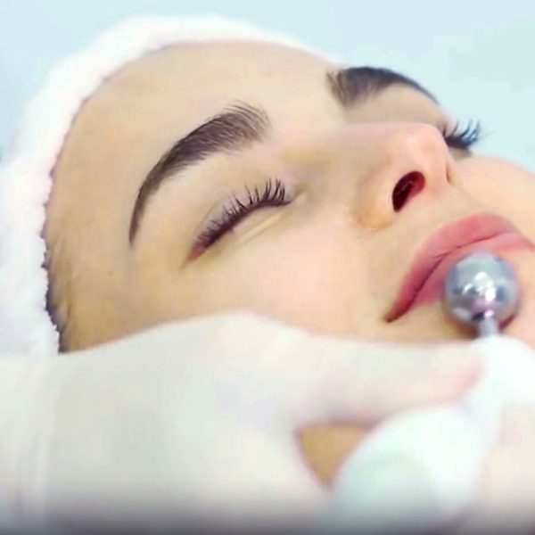 Electrostimulation
