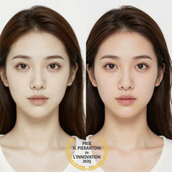 Plasma froid - Soins Experts